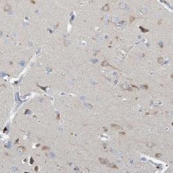anti-Neurotrypsin, Polyclonal, Novus Biologicals 0.1mL; Unlabeled:Antibodies,